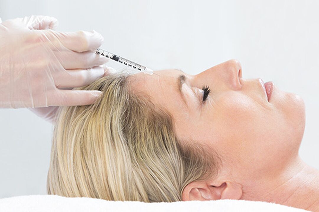 O plasmolifting é un método de inxección de rexuvenecemento da pel facial