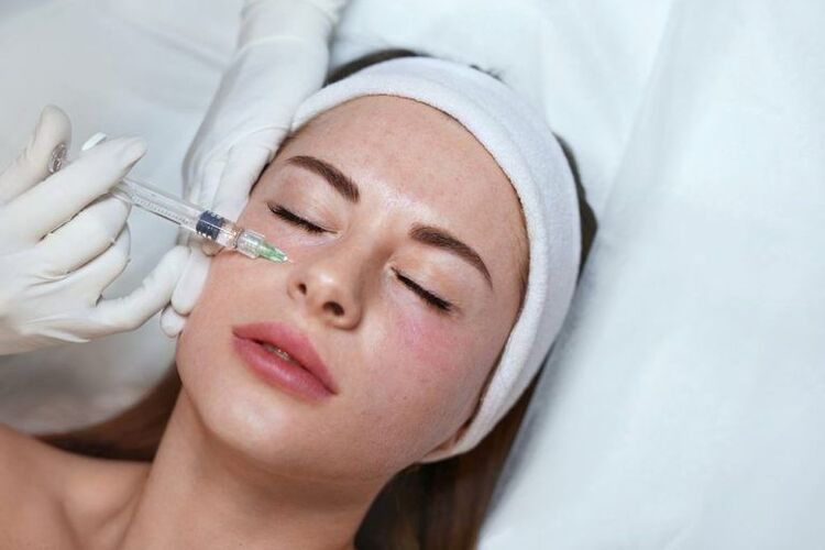 mesoterapia para o rexuvenecemento facial